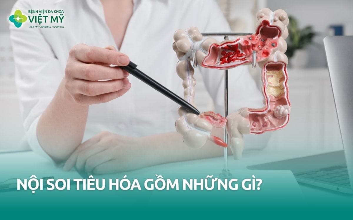 3 phương pháp nội soi tiêu hóa và hình thức thực hiện