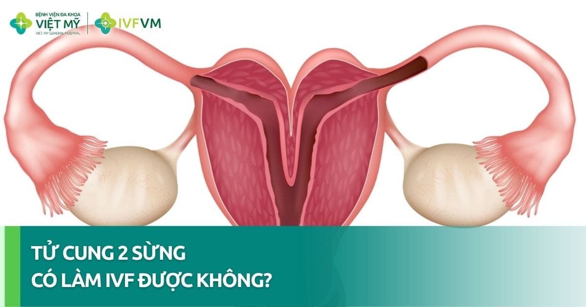Phụ nữ bị tử cung 2 sừng có làm IVF được không? thumb