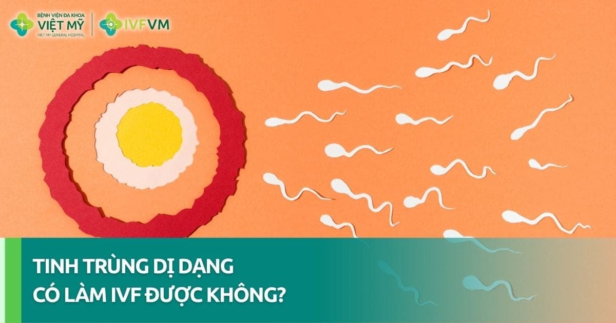 100% Tinh trùng dị dạng có làm IVF được không? thumb