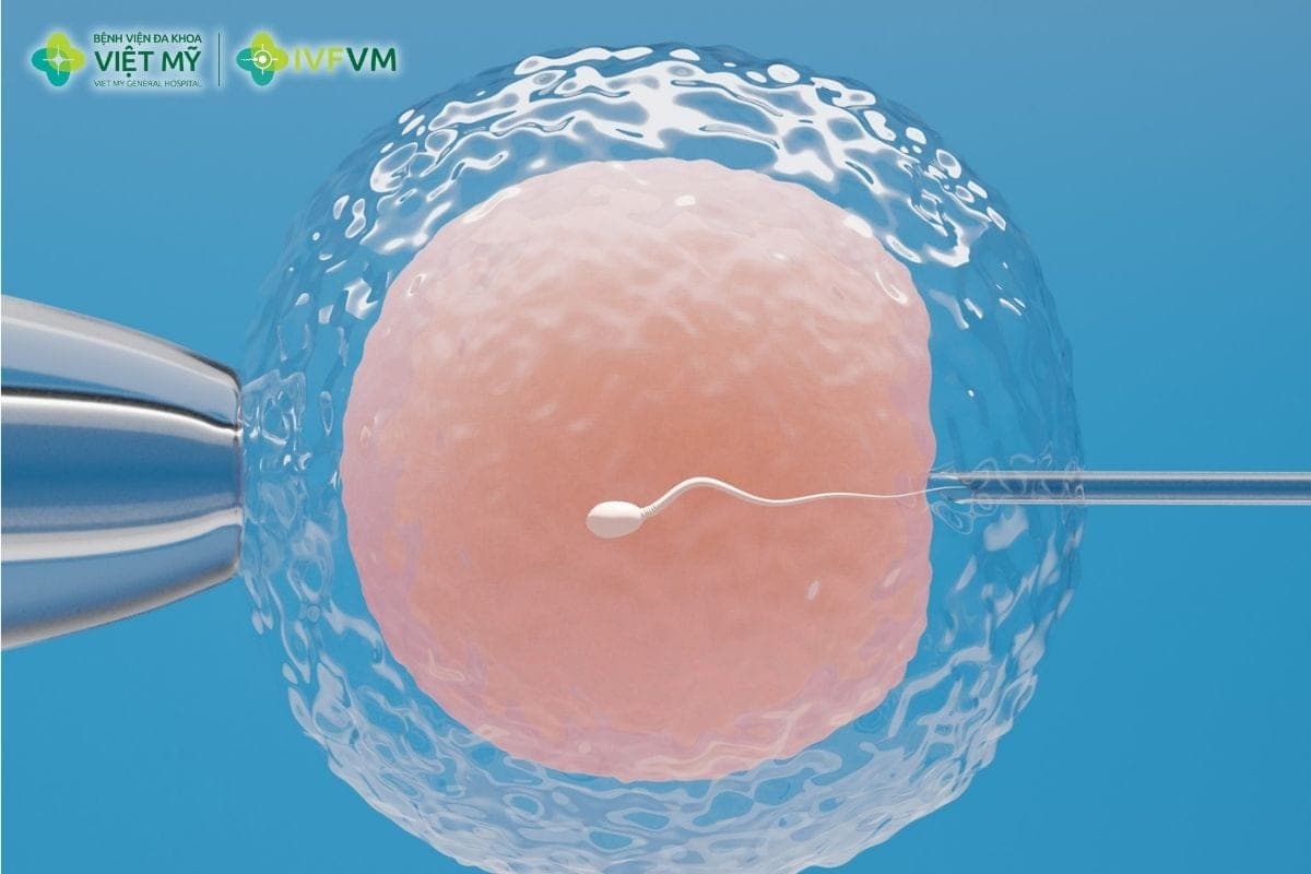 Tinh trùng dị dạng vẫn có thể làm IVF, kể cả khi tỷ lệ bất thường hình thái cao