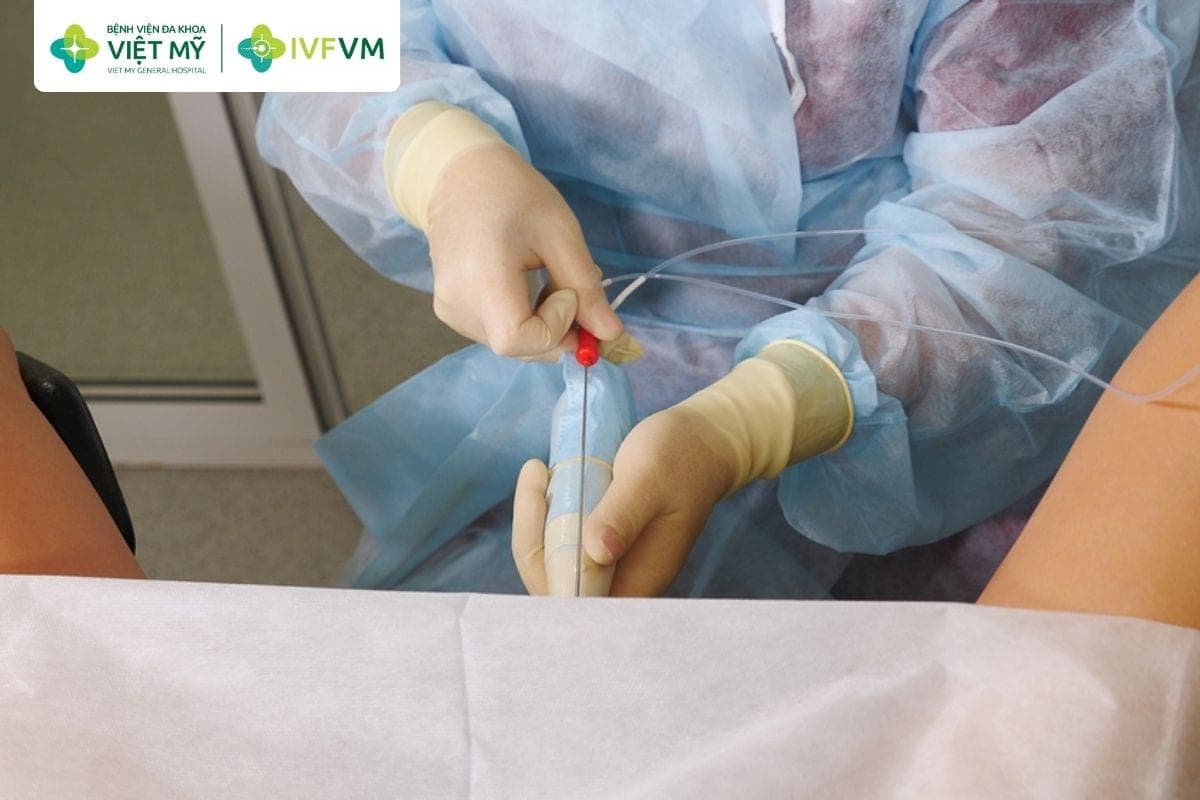 Gom trứng làm IVF giúp tích lũy noãn từ nhiều chu kỳ trước khi tiến hành thụ tinh và tạo phôi