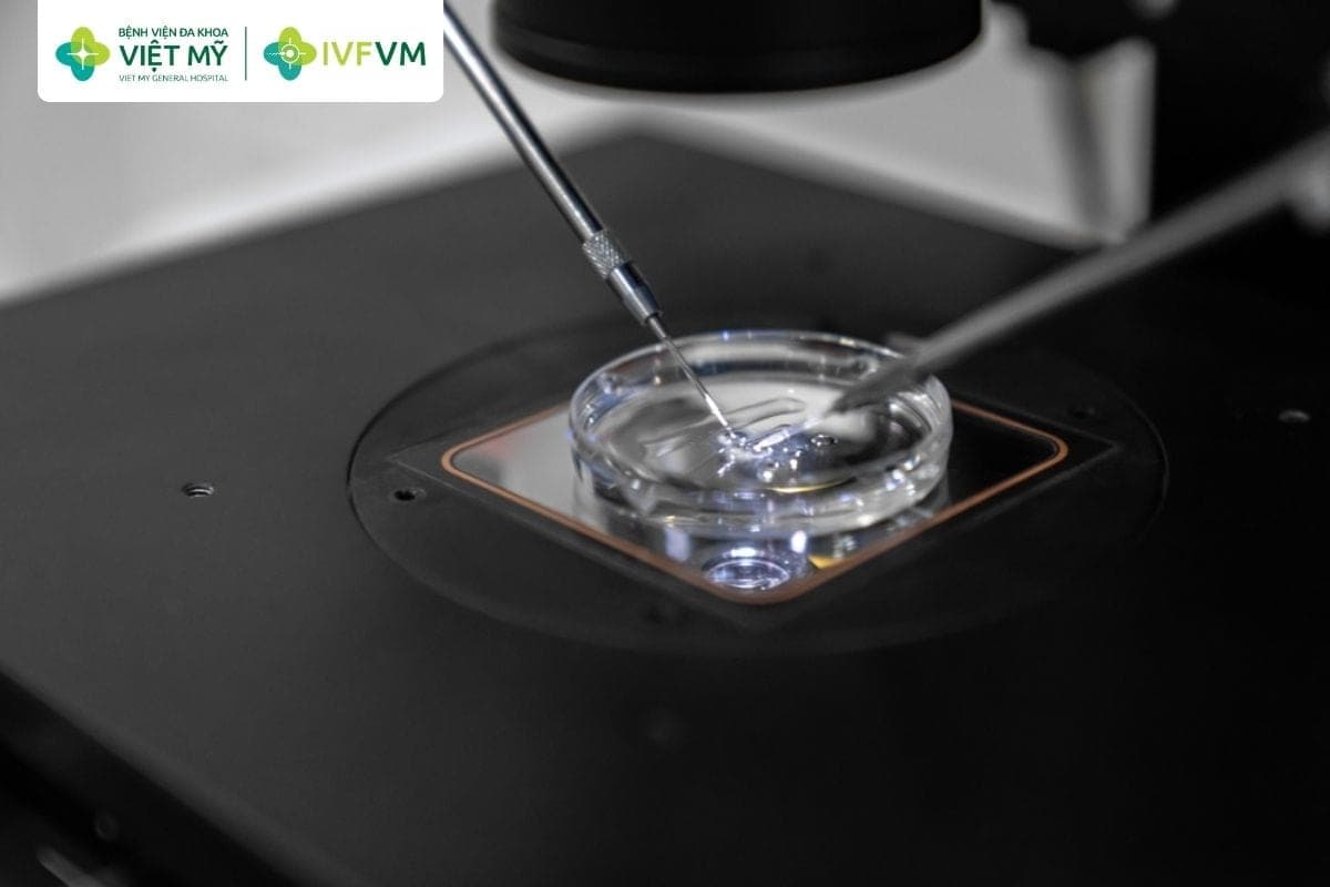 Thụ tinh noãn với tinh trùng hiến và nuôi cấy phôi trong phòng Lab