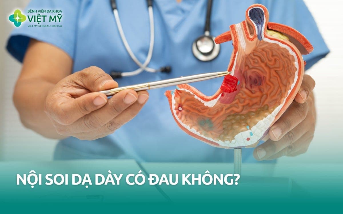 Nội soi dạ dày có đau không? Cảm giác khi soi và cách giảm khó chịu