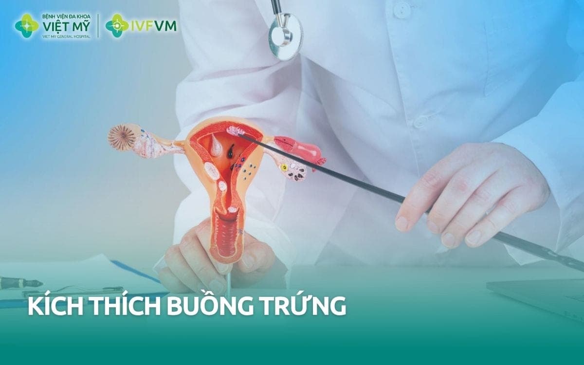 Kích thích buồng trứng là gì? Chỉ định, quy trình và lưu ý