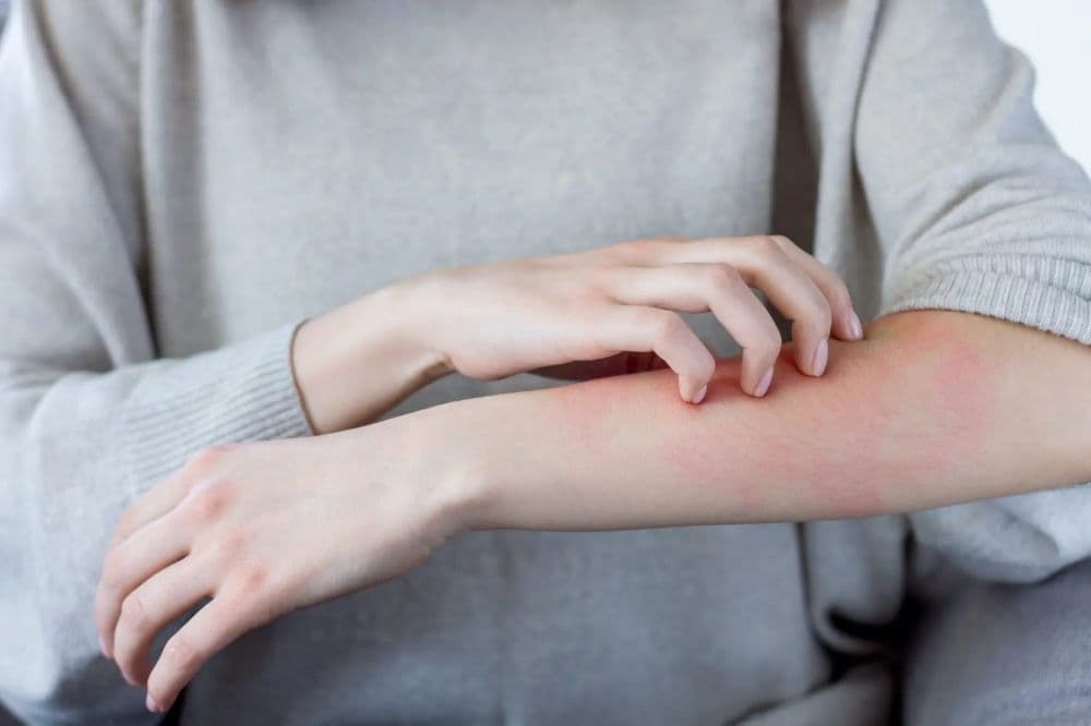 Khám Dị ứng – Miễn dịch: Khi nào cần đi khám và những điều cần biết