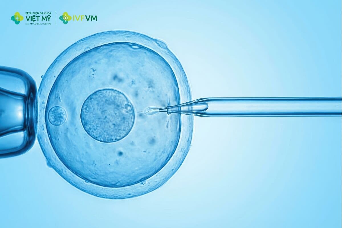 Đột phá của IVF đã làm thay đổi điều trị vô sinh