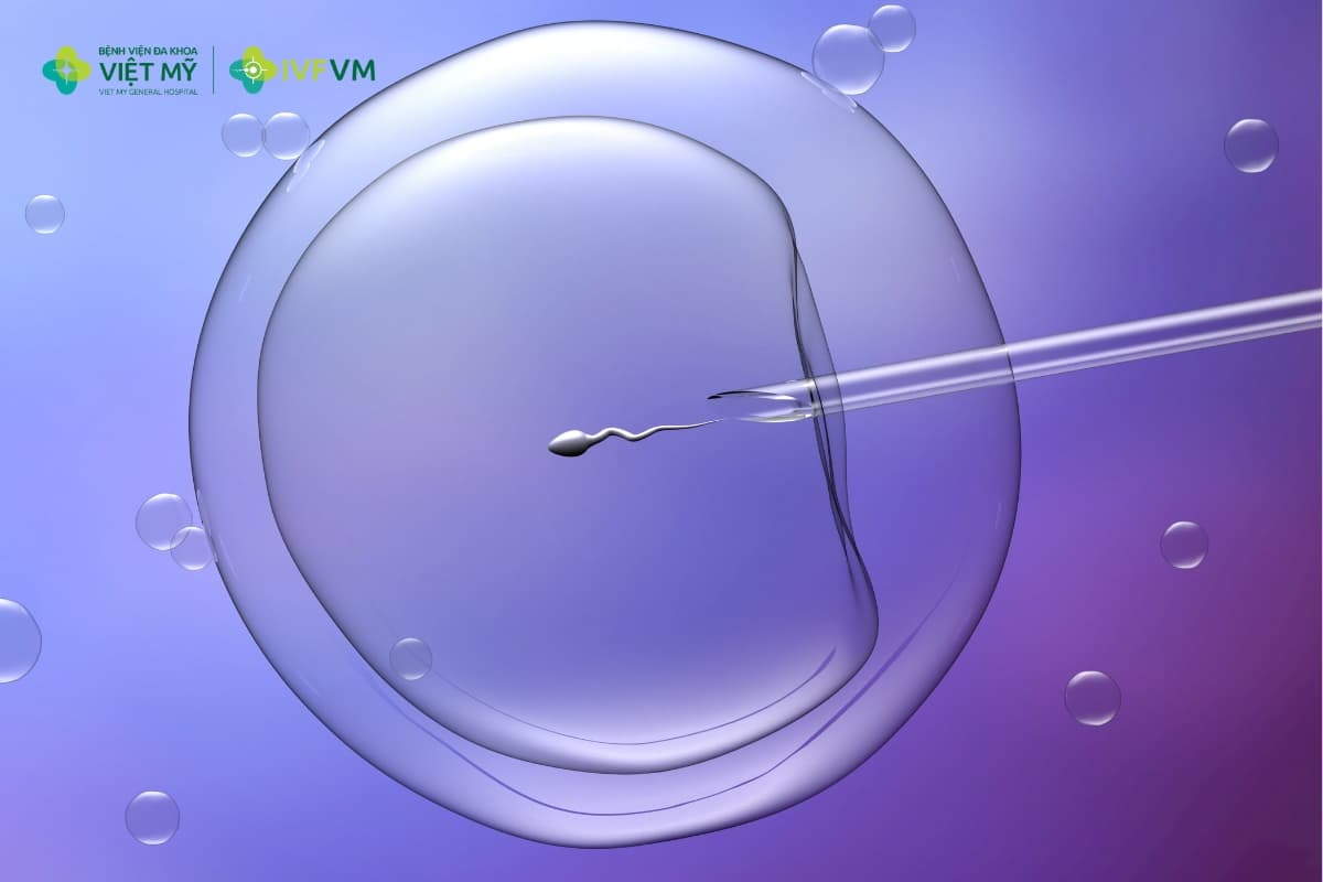 Quyết định chuyển một hay nhiều phôi không dựa riêng vào AI mà còn phụ thuộc nhiều yếu tố