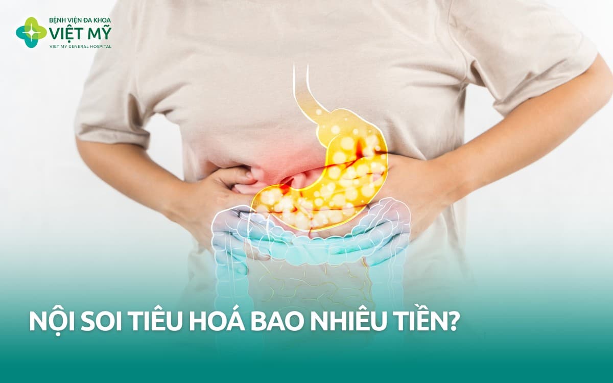 Nội soi tiêu hóa bao nhiêu tiền? Có được tính BHYT không?