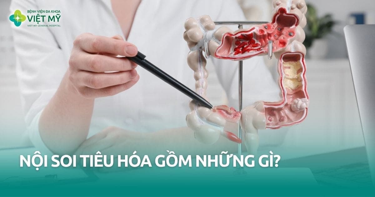 các phương pháp nội soi tiêu hóa thumb