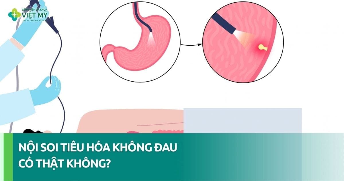 Nội soi tiêu hóa không đau là gì? thumb