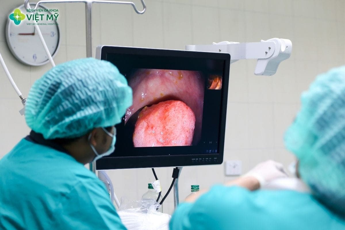 Nội soi gây mê giúp hạn chế đau, buồn nôn và cảm giác khó chịu