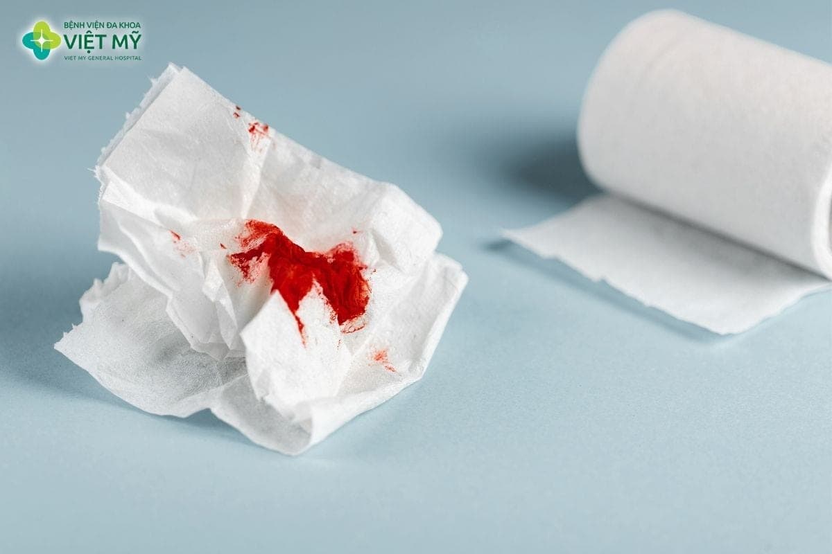 Nôn ra máu là dấu hiệu cảnh báo nghiêm trọng, cần đến cơ sở y tế để được thăm khám và xử trí sớm