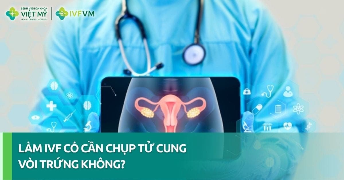 Làm IVF có cần chụp tử cung vòi trứng không? thumb