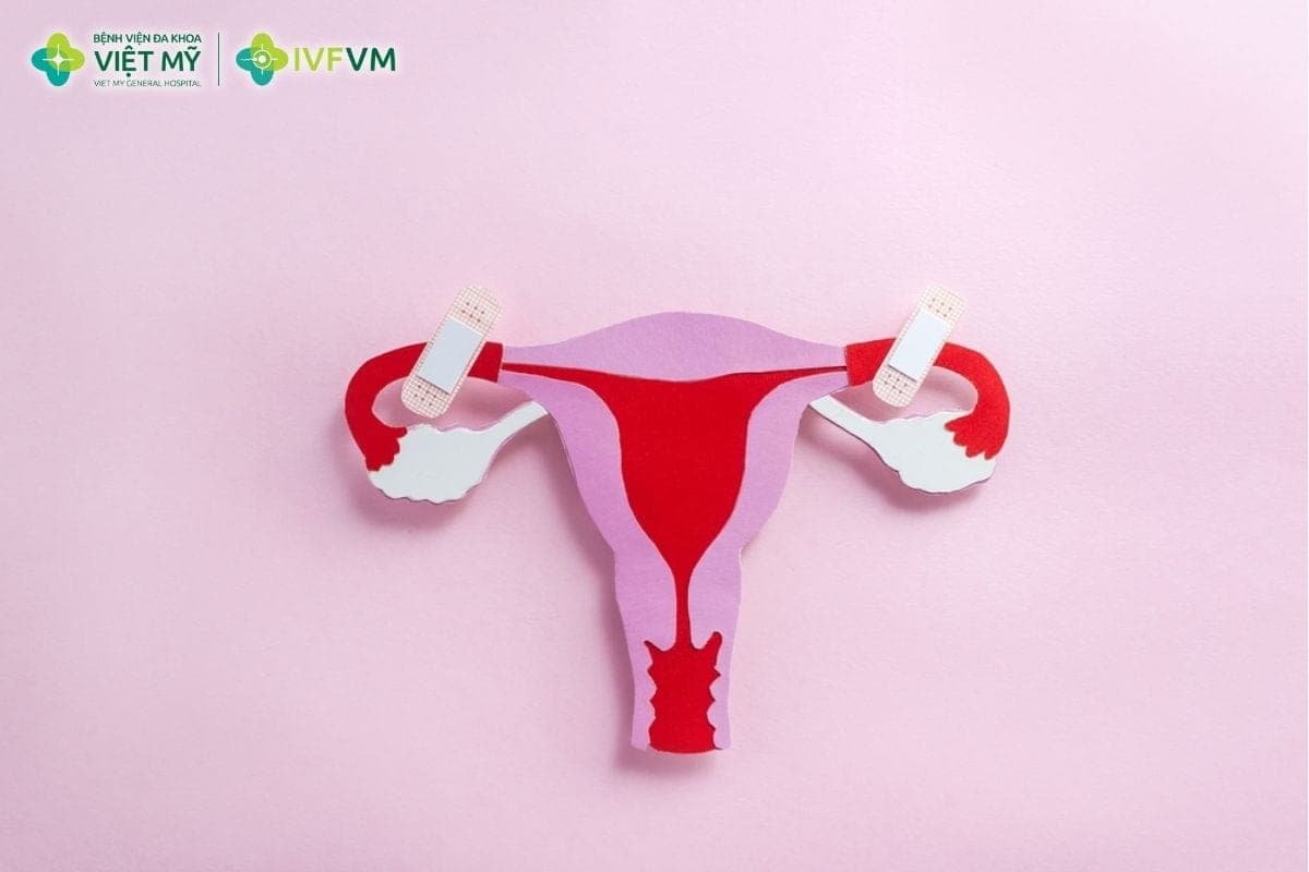 Dính buồng tử cung vẫn có thể làm IVF, nhưng thường cần đánh giá và xử lý buồng tử cung phù hợp trước khi chuyển phôi