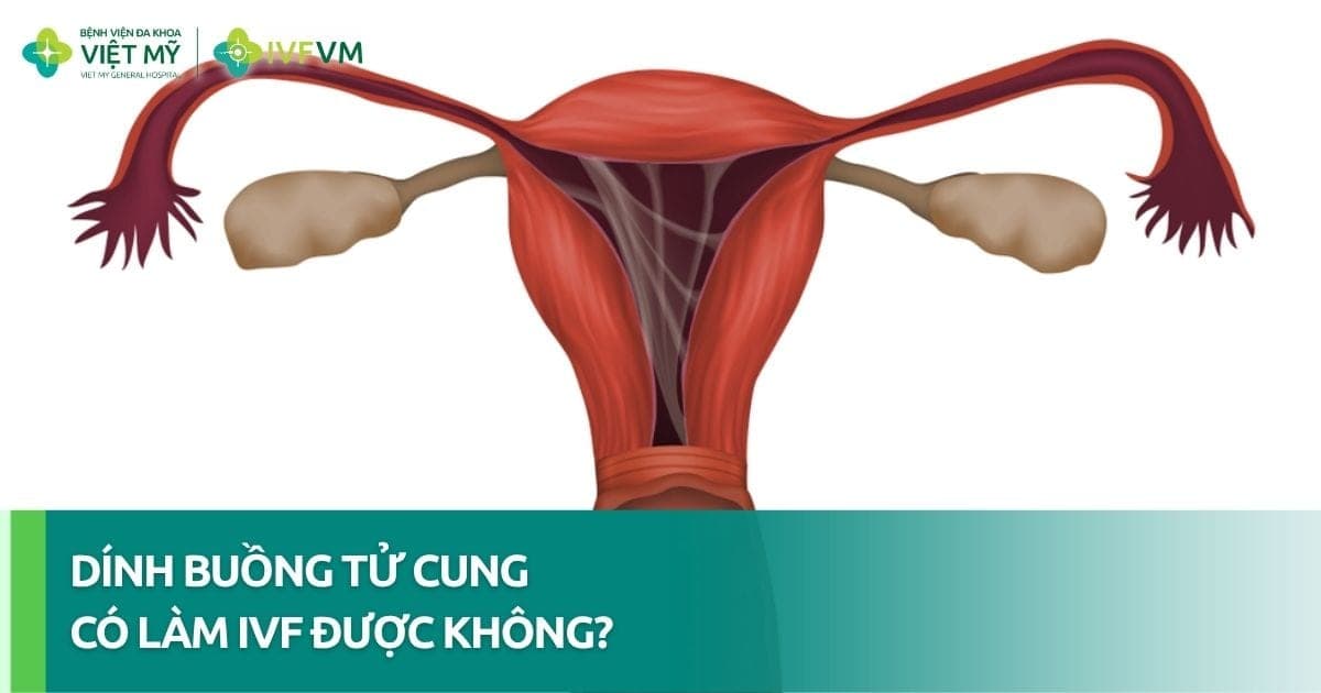 Phụ nữ dính buồng tử cung có làm IVF được không? thumb