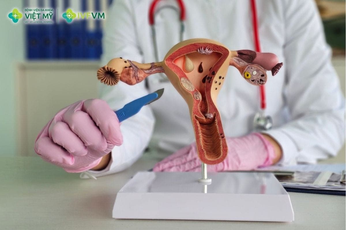Phẫu thuật trước IVF có thể được chỉ định khi khối u gây đau nhiều, cản trở chọc hút noãn, nghi ngờ ác tính hoặc ảnh hưởng đến cơ quan vùng chậu