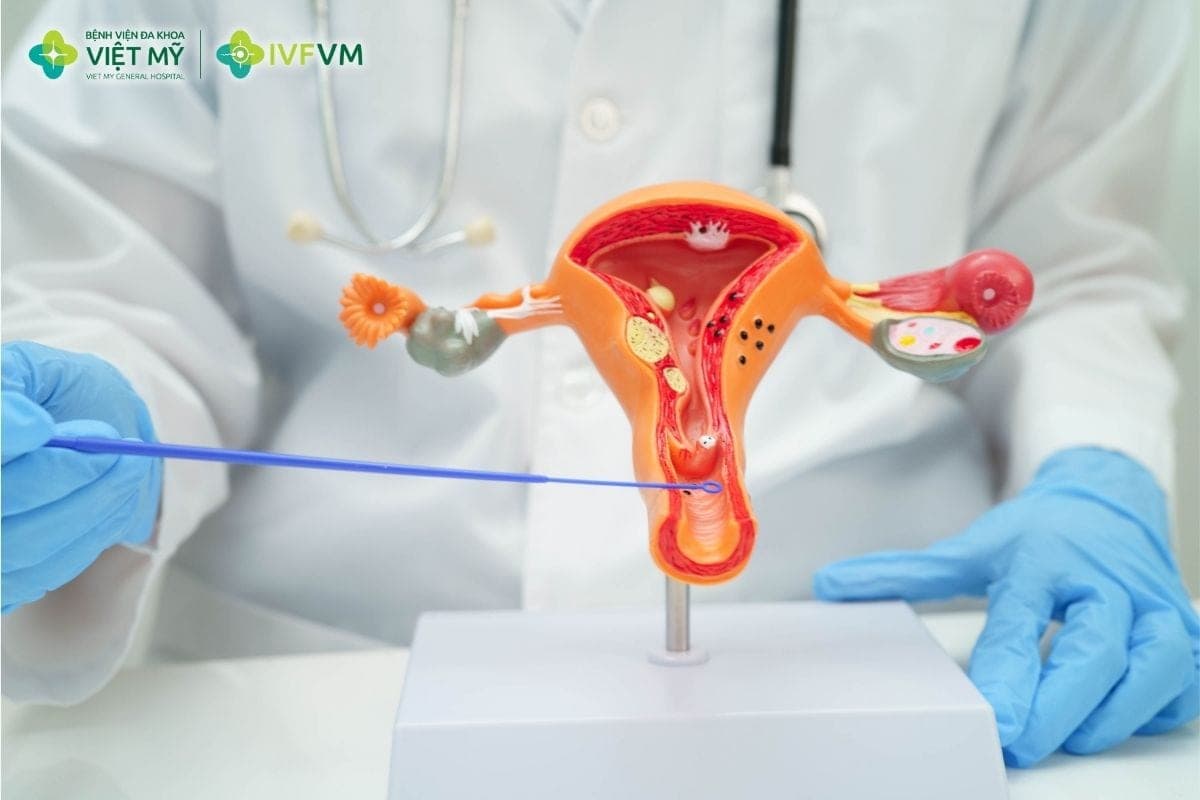 Tắc vòi trứng vẫn có thể làm IVF vì kỹ thuật này không cần noãn và tinh trùng gặp nhau trong vòi trứng