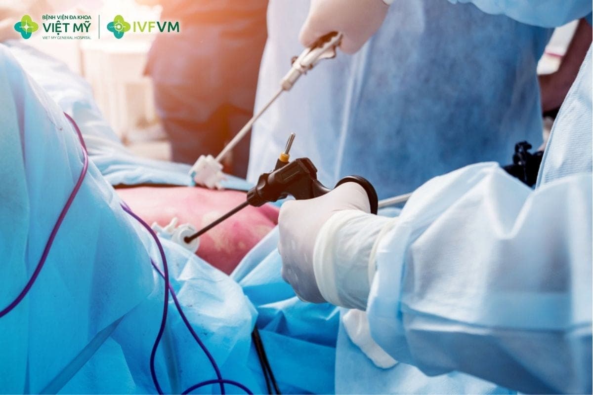 Phẫu thuật nội soi thông tắc vòi trứng có thể cải thiện khả năng mang thai tự nhiên ở một số trường hợp tắc nhẹ