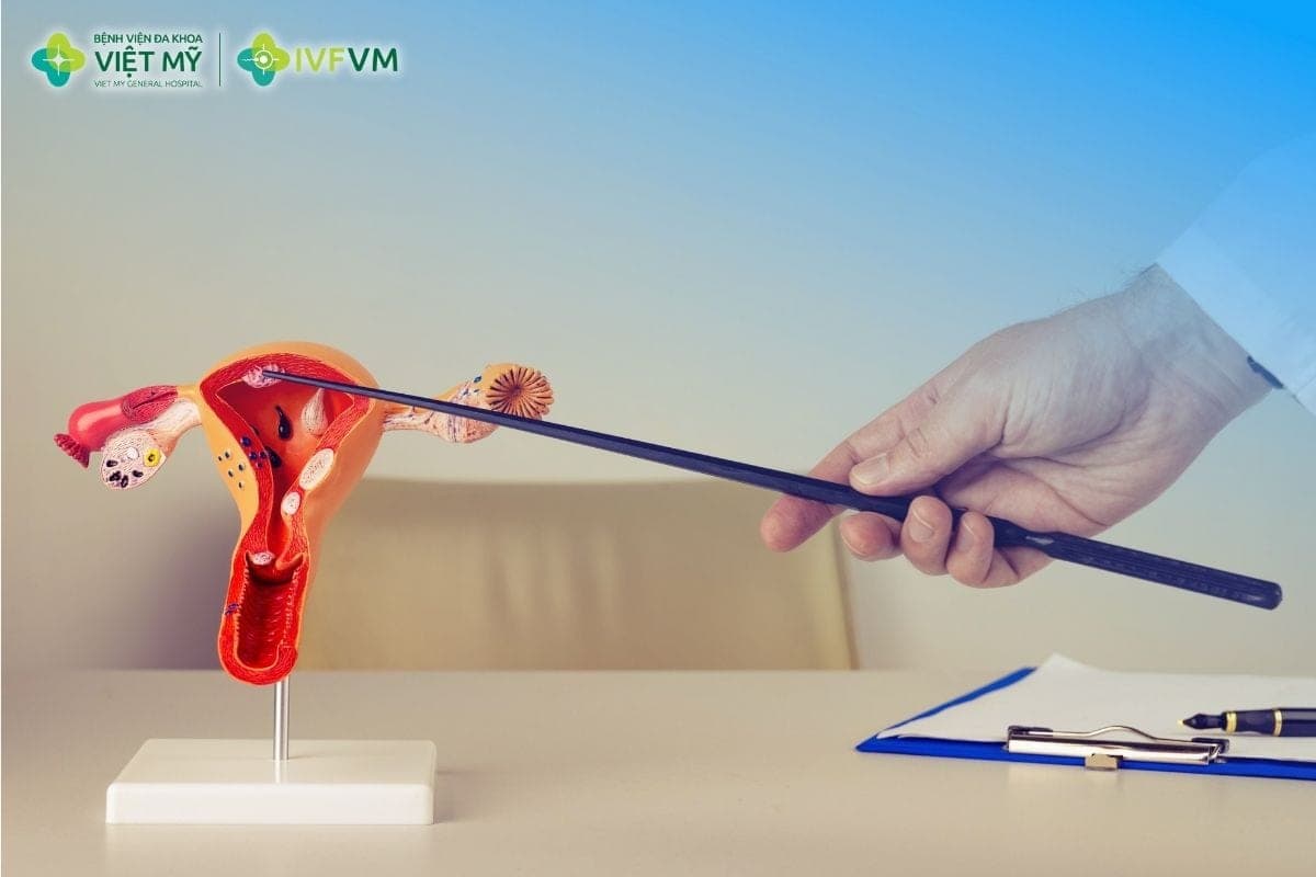 Người bệnh vẫn có thể thực hiện IVF nếu tình trạng viêm nhiễm được kiểm soát và cổ tử cung được đánh giá phù hợp trước chuyển phôi