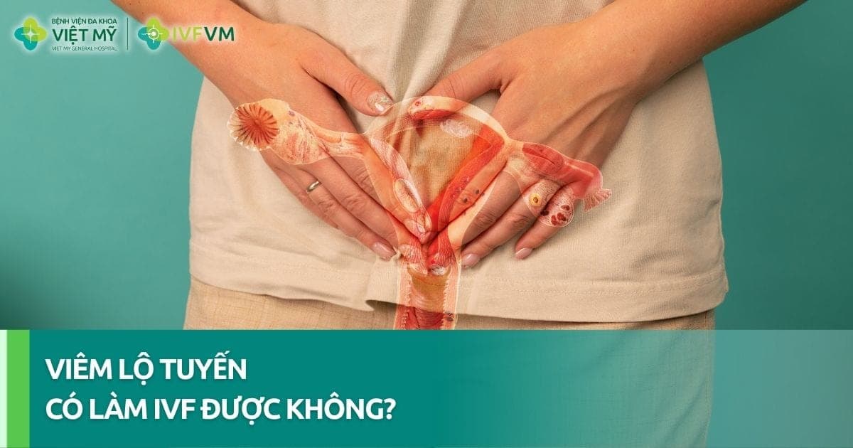 Phụ nữ bị viêm lộ tuyến có làm IVF được không? thumb