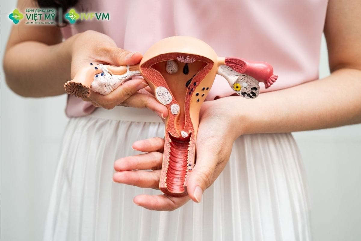 Phụ nữ dự trữ buồng trứng thấp nên cân nhắc IVF sớm khi AMH, AFC giảm hoặc khó mang thai tự nhiên