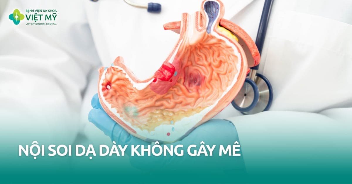 Nội soi dạ dày không gây mê thumb