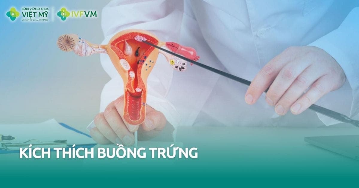Kích thích buồng trứng là gì? thumb