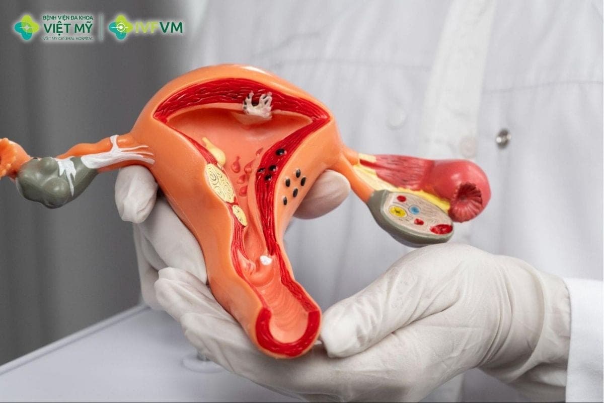 Kích thích trứng làm IVF gồm dùng thuốc, theo dõi nang noãn, tiêm trigger và chọc hút noãn